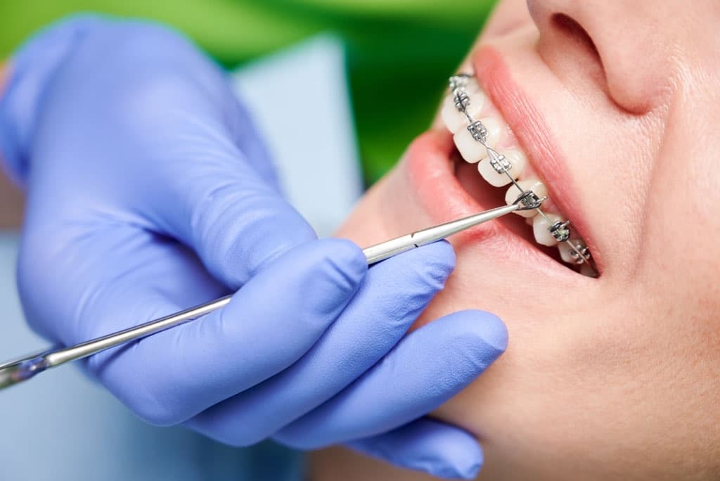 Expert Orthodontics in Milpitas - Sethi Virdi DDS