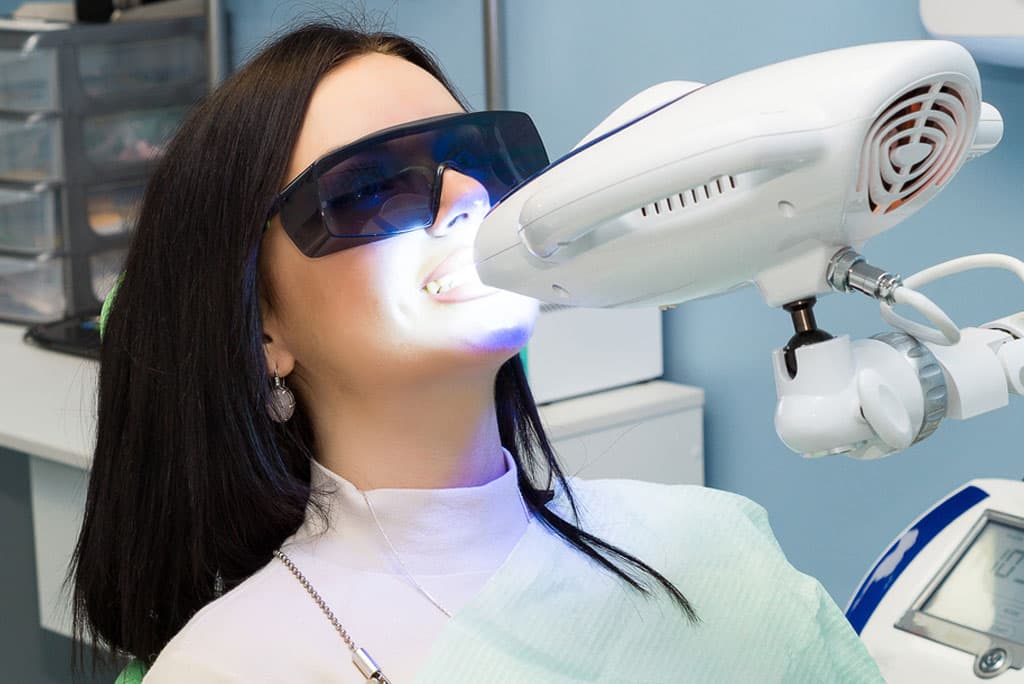 Teeth Whitening in Milpitas - Brighten Your Smile with Professional Care